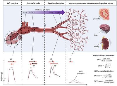 Center-To-Periphery Arterial Stiffness Gradient Is Attenuated and/or Reversed in Pregnancy-Associated Hypertension